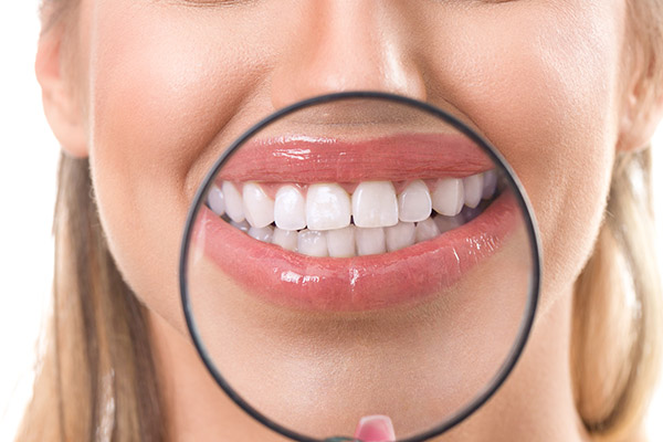 Can a Smile Makeover Correct Dental Imperfections? from Smiles Dental Spa in Tracy, CA