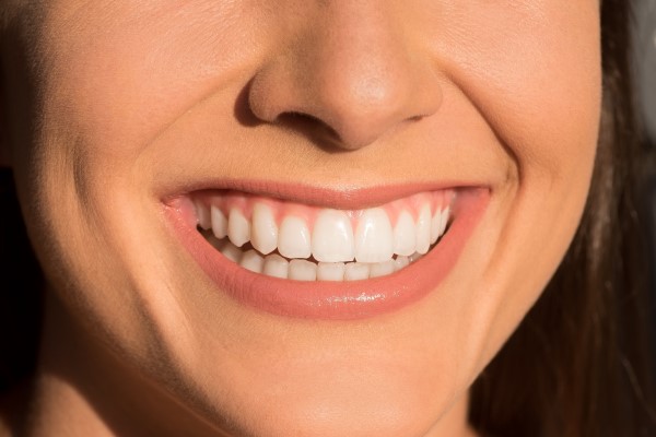 Signs A Patient May Benefit From Dental Bonding