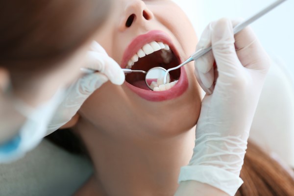 How Often A Dentist Recommends A Dental Cleaning