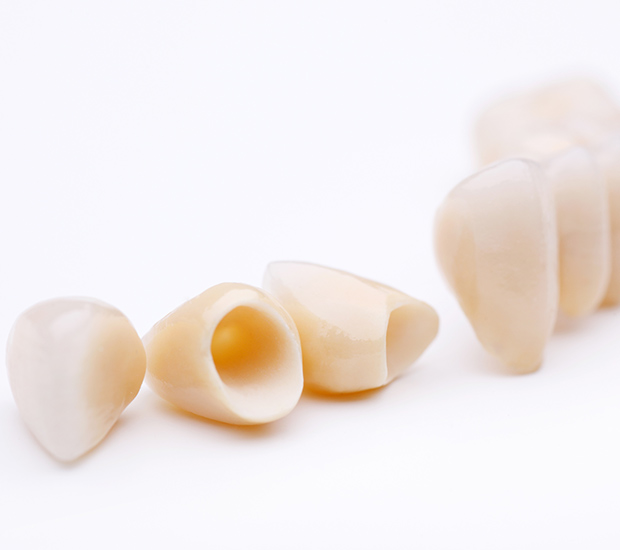 Tracy Dental Crowns and Dental Bridges