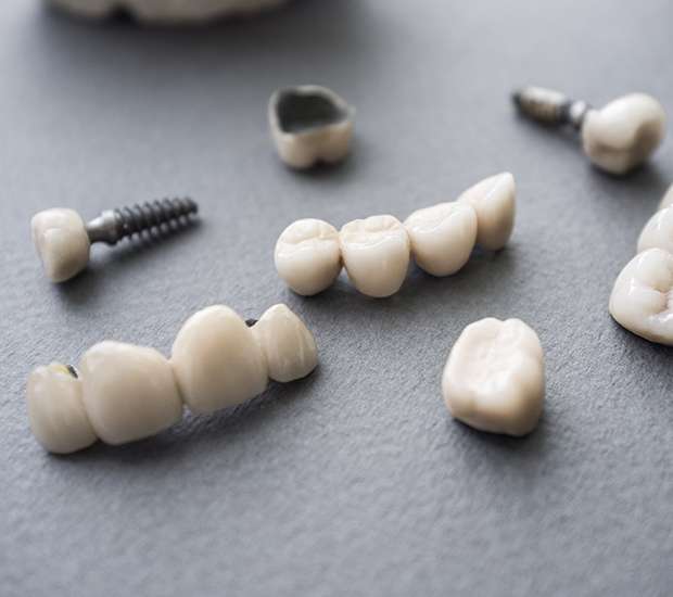 Tracy The Difference Between Dental Implants and Mini Dental Implants