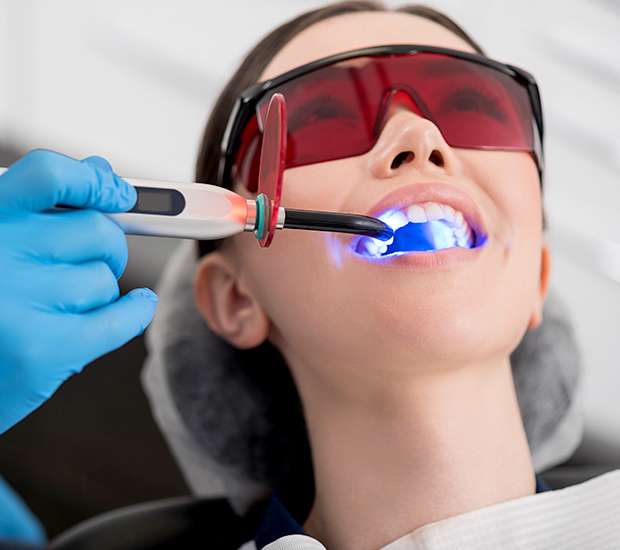 Tracy Professional Teeth Whitening